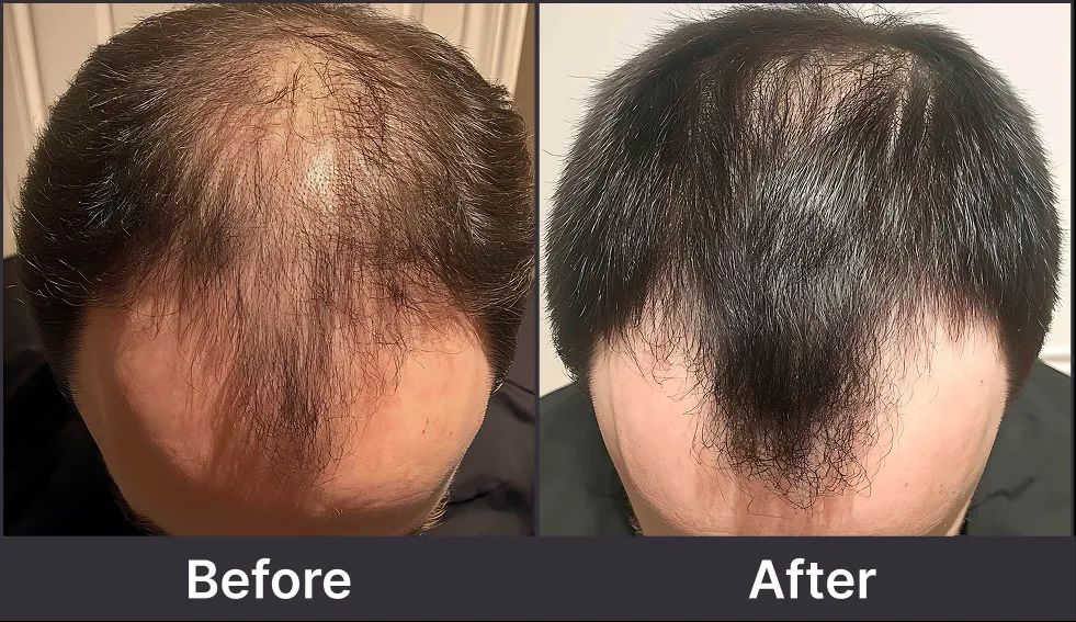 30代男性の症例写真 Before/After
