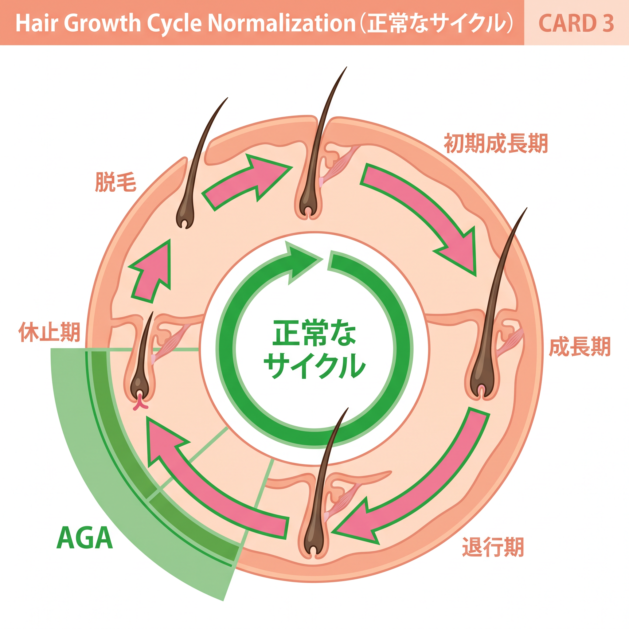 発毛周期の再起動のメカニズム図解：乱れていた毛髪の成長サイクルを整え、太く長く育てる環境を作る毛周期正常化治療